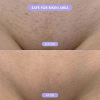 Ama & Co - Hair Removal Mousse
